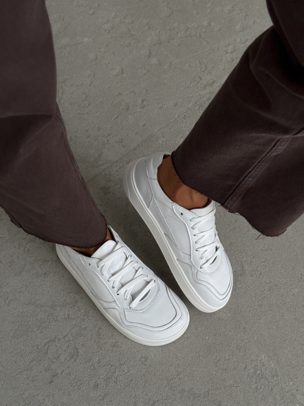 Variation Gallery Image